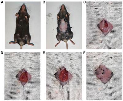 A novel insulin delivery system by β cells encapsulated in microcapsules